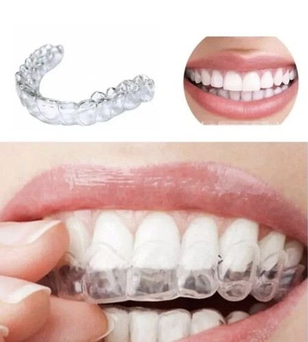 Teeth whitening mouth - 4,