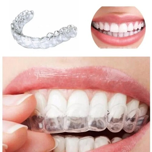 Teeth whitening mouth - 4, x